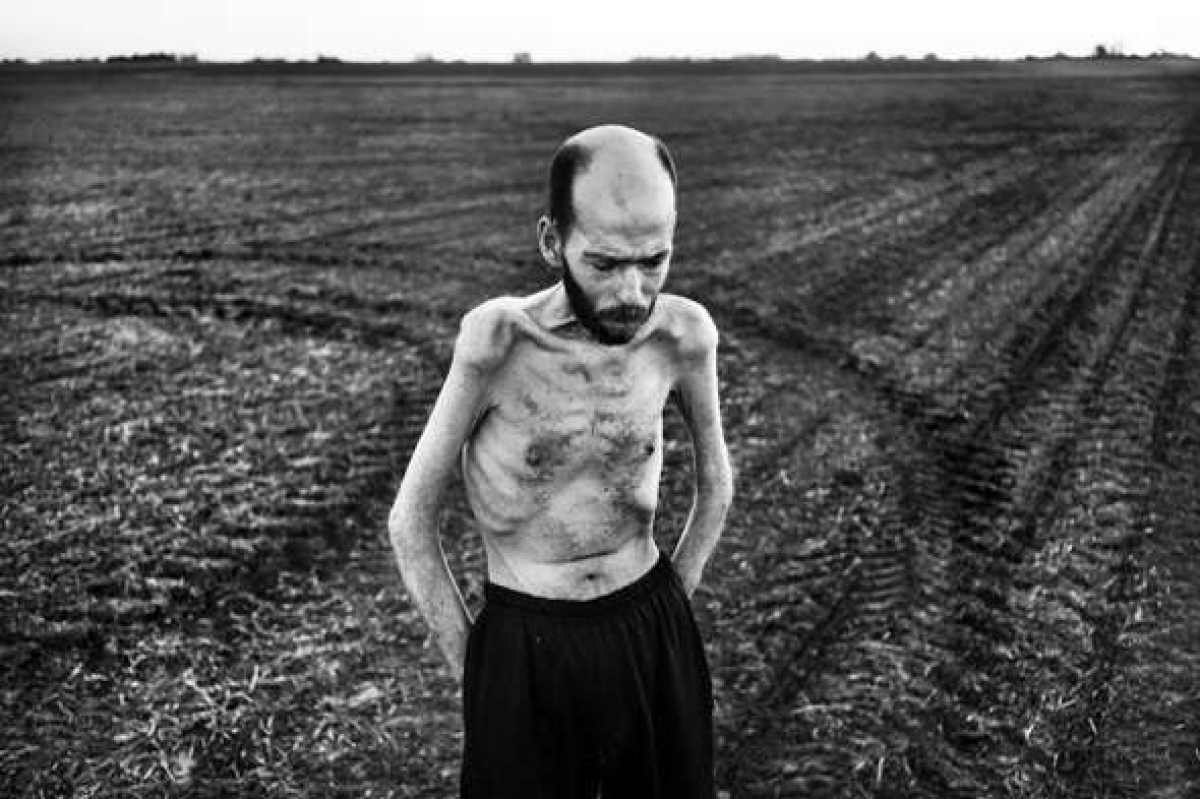 Foto de Pablo Piovano a Fabián Tomasi que forma parte del fotoreportaje “El costo humano de los agrotóxicos”